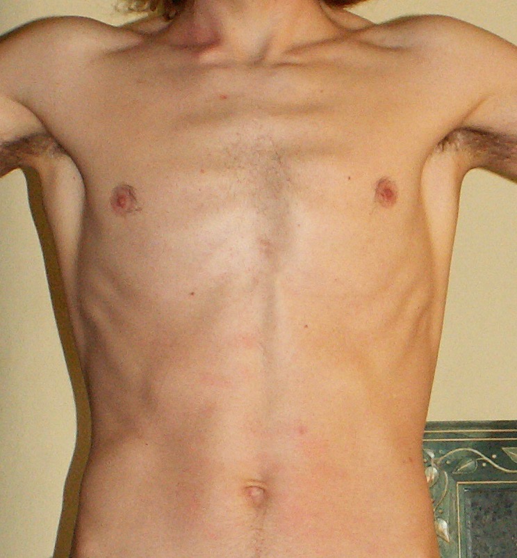 PICT0004